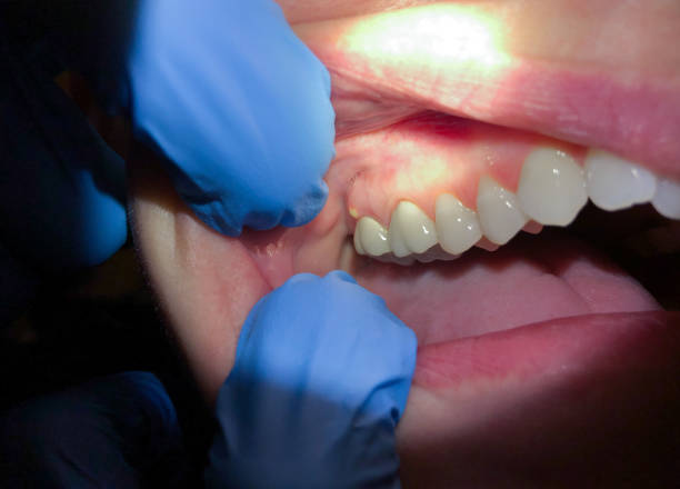 Best Orthodontic Emergency Dentist in Au Sable, MI